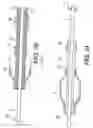 Fig. 13 - Embolic protection device