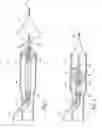 Fig. 02 - Intravascular filter retrieval device having an actuatable dilator tip