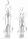 Fig. 03 - Intravascular filter retrieval device having an actuatable dilator tip