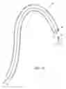 Fig. 12 - Intravascular filter retrieval device having an actuatable dilator tip
