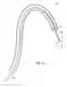Fig. 13 - Intravascular filter retrieval device having an actuatable dilator tip