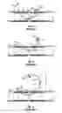 Fig. 03 - Sickle needle and method