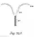 Fig. 20 - Temporary retention device