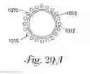 Fig. 30 - Temporary retention device