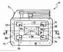 Fig. 01 - Active implantable medical device with RF telemetry and subcutaneous ECG electrodes