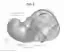 Fig. 03 - Direct and Indirect Control of Muscle for the Treatment of Pathologies