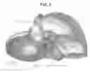 Fig. 04 - Direct and Indirect Control of Muscle for the Treatment of Pathologies