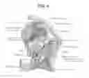 Fig. 05 - Direct and Indirect Control of Muscle for the Treatment of Pathologies