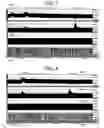 Fig. 07 - Electrical stimulation treatment of bronchial constriction