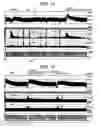 Fig. 09 - Electrical stimulation treatment of bronchial constriction