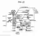 Fig. 14 - Electrical stimulation treatment of bronchial constriction