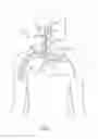 Fig. 02 - ELECTRODE STRUCTURES AND METHODS FOR THEIR USE IN CARDIOVASCULAR REFLEX CONTROL