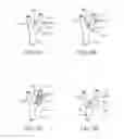 Fig. 06 - ELECTRODE STRUCTURES AND METHODS FOR THEIR USE IN CARDIOVASCULAR REFLEX CONTROL