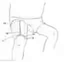 Fig. 01 - Apparatus for applying electrical current to the neuromuscular system