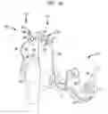 Fig. 02 - Transformable speech processor module for a hearing prosthesis
