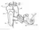 Fig. 01 - General purpose accessory for a cochlear implant system