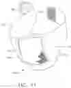 Fig. 09 - Body conforming textile holder and thermal article