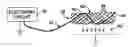 Fig. 01 - Intravascular Electronics Carrier Electrode for a Transvascular Tissue Stimulation System