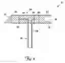 Fig. 04 - Tissue stimulating lead and method of implantation and manufacture