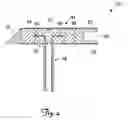 Fig. 05 - Tissue stimulating lead and method of implantation and manufacture