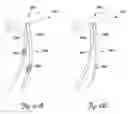 Fig. 10 - Tissue stimulating lead and method of implantation and manufacture