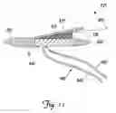 Fig. 12 - Tissue stimulating lead and method of implantation and manufacture