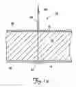 Fig. 14 - Tissue stimulating lead and method of implantation and manufacture