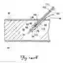 Fig. 15 - Tissue stimulating lead and method of implantation and manufacture