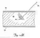 Fig. 16 - Tissue stimulating lead and method of implantation and manufacture