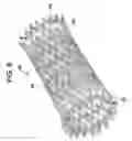 Fig. 07 - Deployment system for an intraluminal medical device