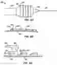 Fig. 09 - Stent deployment systems and methods