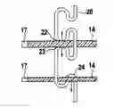Fig. 01 - Application system for a stent