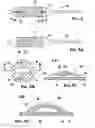 Fig. 03 - Application system for a stent