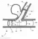 Fig. 01 - Graft-stent assembly