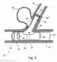 Fig. 03 - Graft-stent assembly
