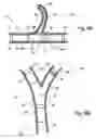 Fig. 07 - Graft-stent assembly