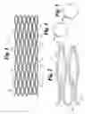 Fig. 02 - Flexible stent