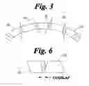 Fig. 03 - Flexible stent
