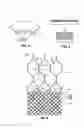 Fig. 04 - Multi-section filamentary endoluminal stent