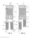 Fig. 07 - Multi-section filamentary endoluminal stent
