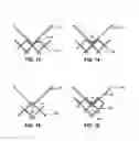Fig. 08 - Multi-section filamentary endoluminal stent