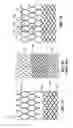 Fig. 09 - Multi-section filamentary endoluminal stent
