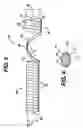 Fig. 04 - Biodegradable stent
