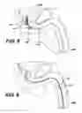 Fig. 08 - Biodegradable stent