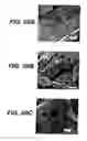 Fig. 14 - Biodegradable stent