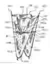 Fig. 01 - Implantable medical device with constrained expansion