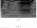 Fig. 08 - Radiopaque coating for biomedical devices