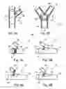 Fig. 03 - Bifurcated stent assembly