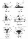 Fig. 04 - Bifurcated stent assembly