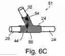 Fig. 05 - Bifurcated stent assembly